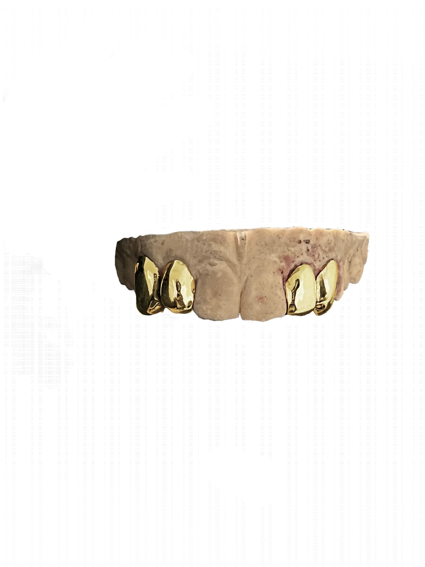 GOLD 4 CAP GRILLZ