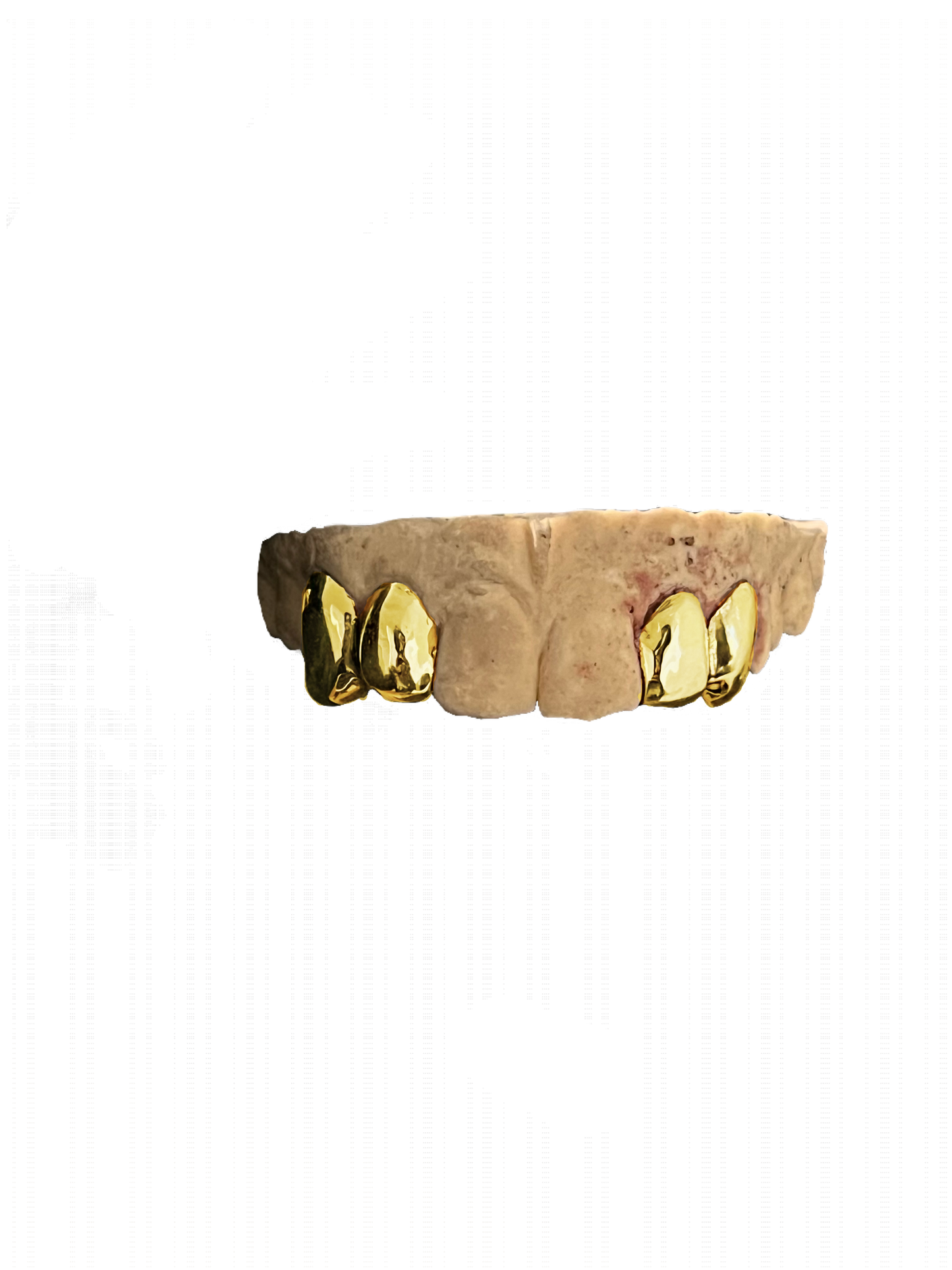 GOLD 4 CAP GRILLZ